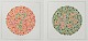 Ishihara - Farbsinnst�rungen