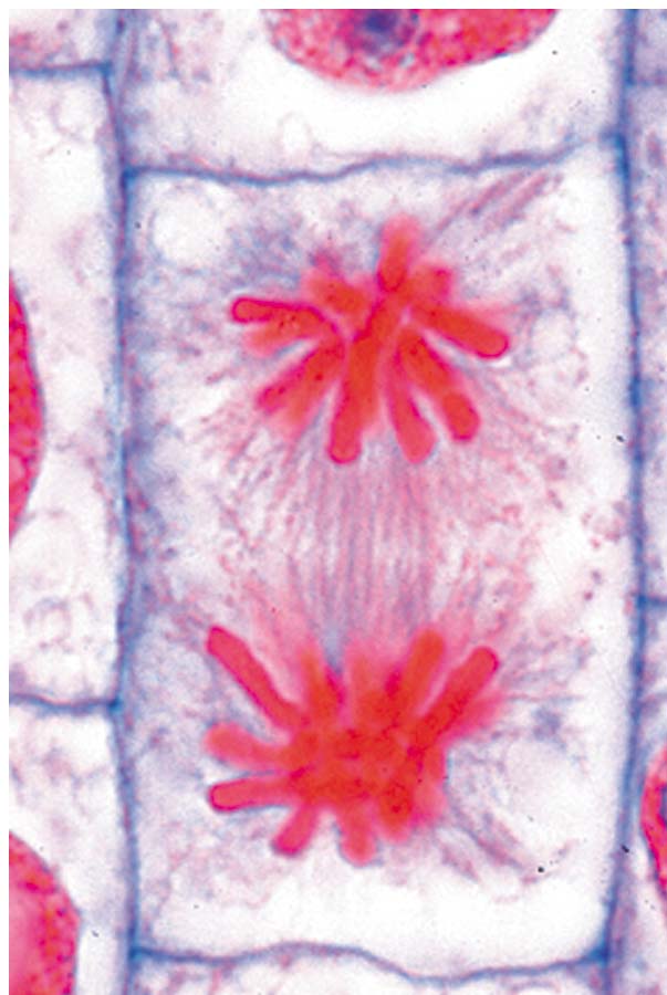 Präparate - Mitose und Meiose (Zellteilung), 5504905 ...